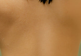 How To Clear and Control Body Acne