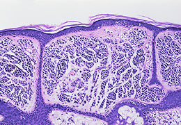 The Brief, Heroic Life of a Skin Cell