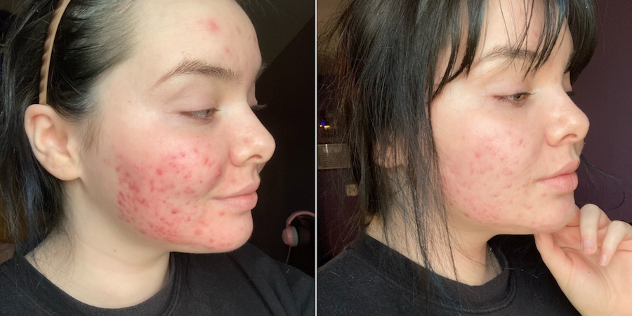 A Conversation with @tv.skinjournal About Finding Something That Works