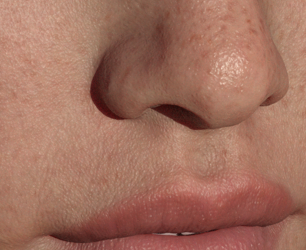 5 Questions About Pores Answered