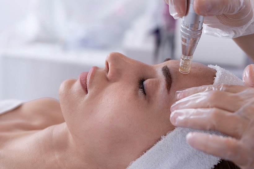 microneedling tools laid out on a pink background
