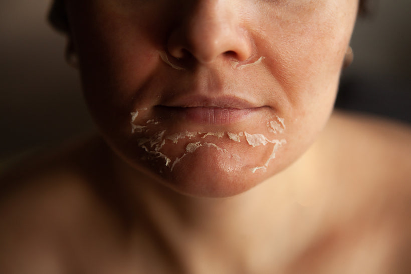 Facial or a Peel: What’s the Difference and Which Should You Get?