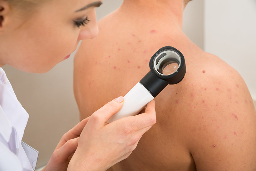 Things That Look Like Acne But Aren’t