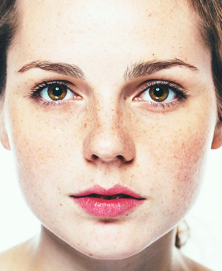 Taking Care of Fair and Freckled Skin