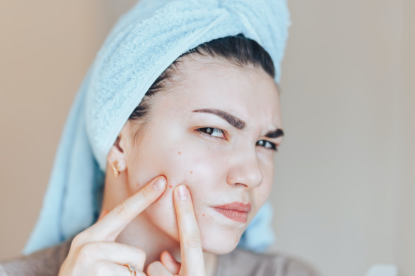 Best acne treatments 