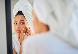 Say Bye, Bye to Blackheads