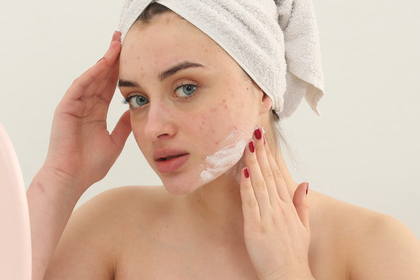 Are Acne Scars Reversible?