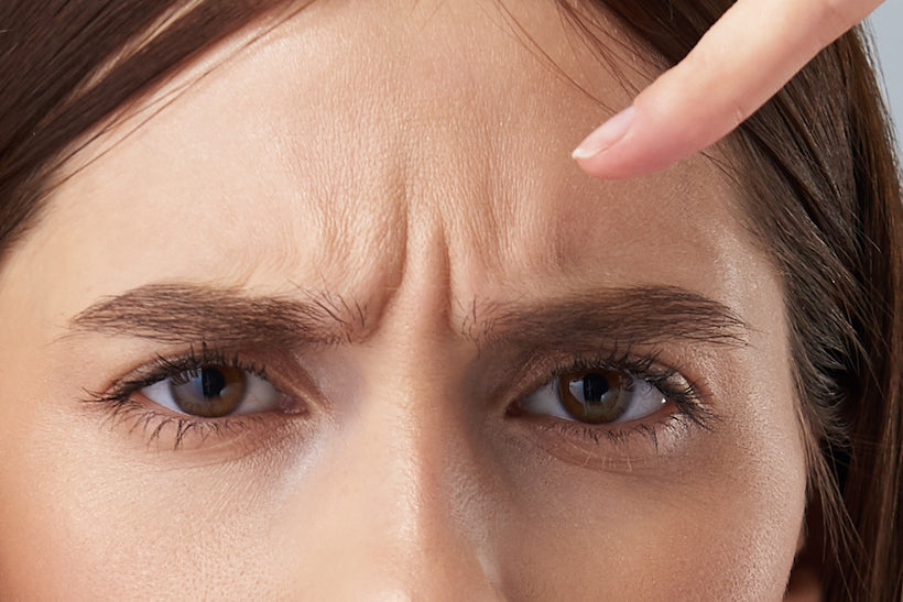 What are the elevens? Forehead frown lines between eyebrows.