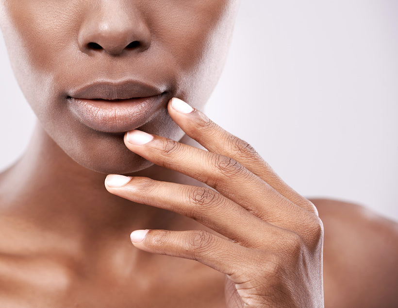 are chin pimples a sign of hormonal acne